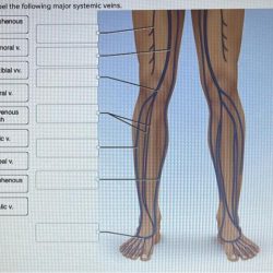 Correctly label the following major systemic arteries