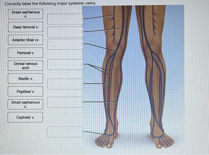 Correctly label the following major systemic arteries