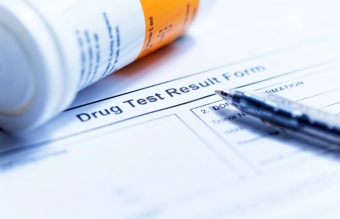 Alcohol test drug dmv answers