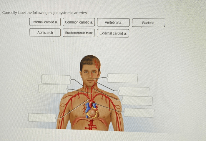 Correctly label the following major systemic arteries